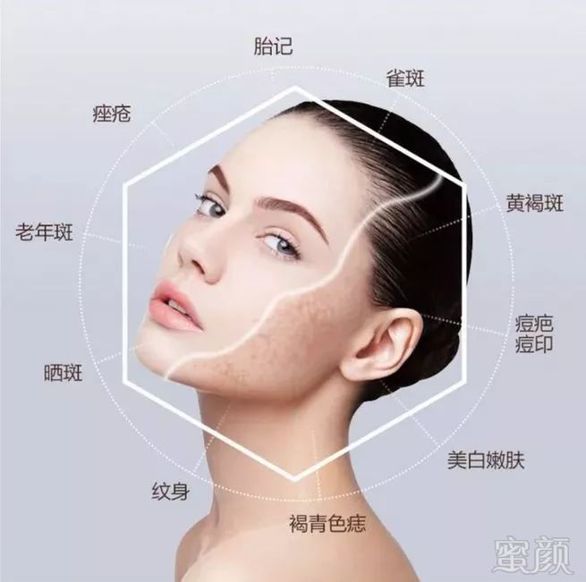 https://img.miyanlife.com/mnt/timg/190708/1101453P8-4.jpg