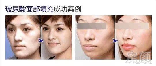 https://img.miyanlife.com/mnt/timg/190708/1150194a2-7.jpg