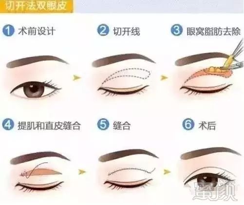https://img.miyanlife.com/mnt/timg/190709/1200195435-4.jpg