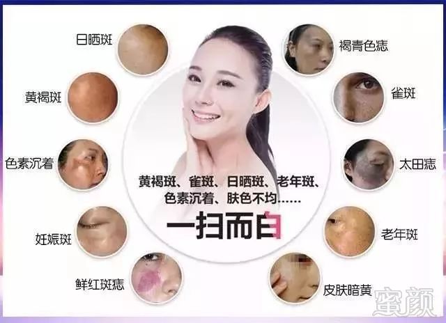 https://img.miyanlife.com/mnt/timg/190709/12052V432-3.jpg