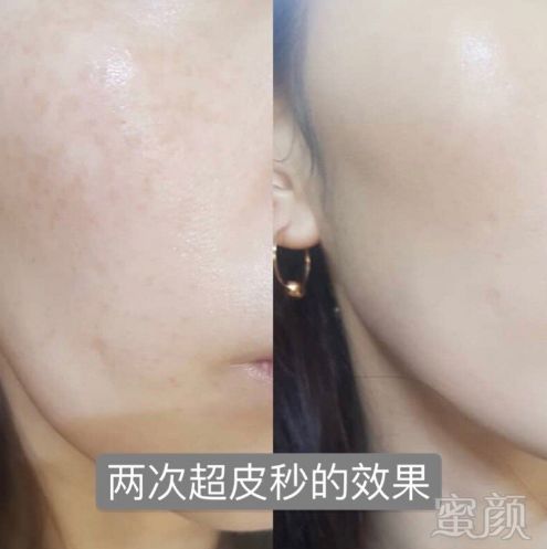 https://img.miyanlife.com/mnt/timg/190709/1206403E0-9.jpg