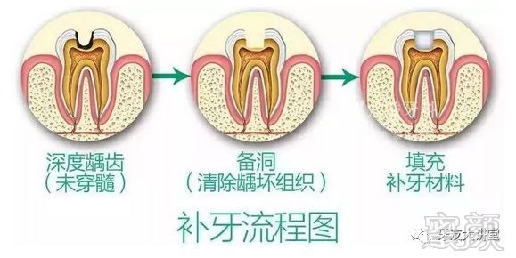 案例图片