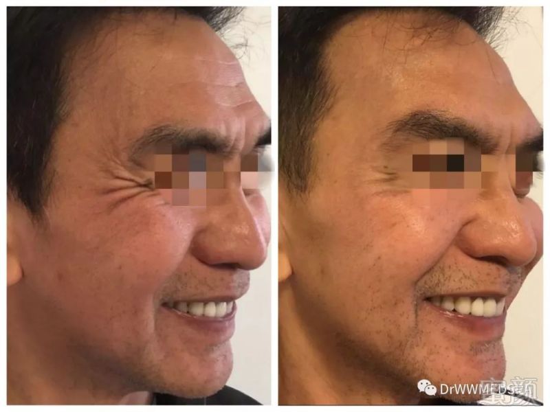 https://img.miyanlife.com/mnt/timg/190709/12294AJ5-2.jpg