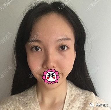 https://img.miyanlife.com/mnt/timg/190709/12512G312-0.jpg