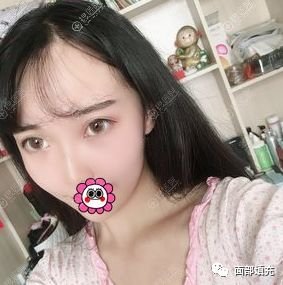 https://img.miyanlife.com/mnt/timg/190709/12512IQ6-1.jpg