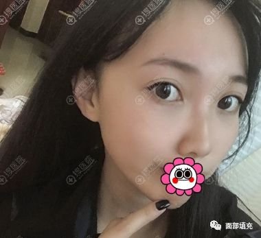 https://img.miyanlife.com/mnt/timg/190709/12512L291-4.jpg