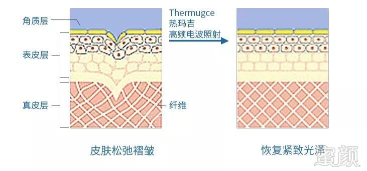 https://img.miyanlife.com/mnt/timg/190709/12560S341-3.jpg