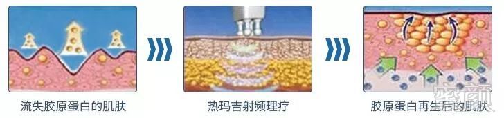 https://img.miyanlife.com/mnt/timg/190709/12560U263-2.jpg