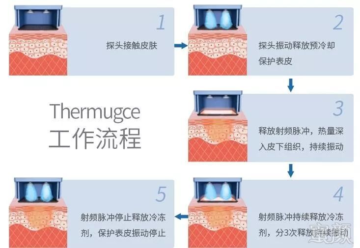 https://img.miyanlife.com/mnt/timg/190709/125610G15-5.jpg