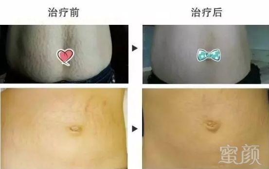 https://img.miyanlife.com/mnt/timg/190710/1530512X6-9.jpg