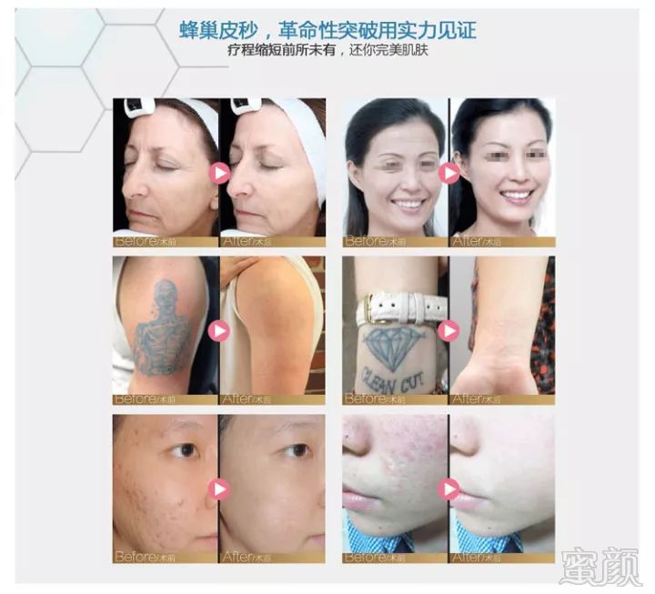 https://img.miyanlife.com/mnt/timg/190710/154Z34127-2.jpg