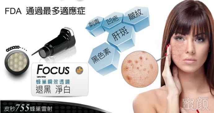 https://img.miyanlife.com/mnt/timg/190710/154Z3C15-1.jpg