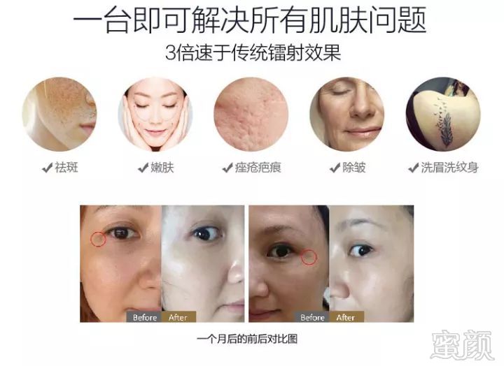 https://img.miyanlife.com/mnt/timg/190710/154Z51125-3.jpg