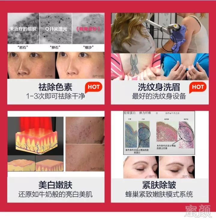 https://img.miyanlife.com/mnt/timg/190710/154ZR2b-5.jpg