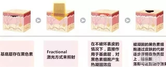 https://img.miyanlife.com/mnt/timg/190710/15510R526-7.jpg