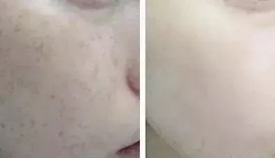https://img.miyanlife.com/mnt/timg/190710/15512032A-11.jpg