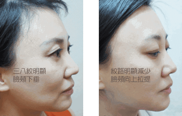 https://img.miyanlife.com/mnt/timg/190710/162033B42-11.jpg