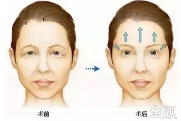 https://img.miyanlife.com/mnt/timg/190710/16203I645-14.jpg