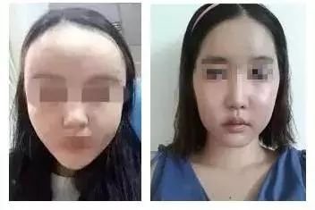 https://img.miyanlife.com/mnt/timg/190711/1220404402-3.jpg