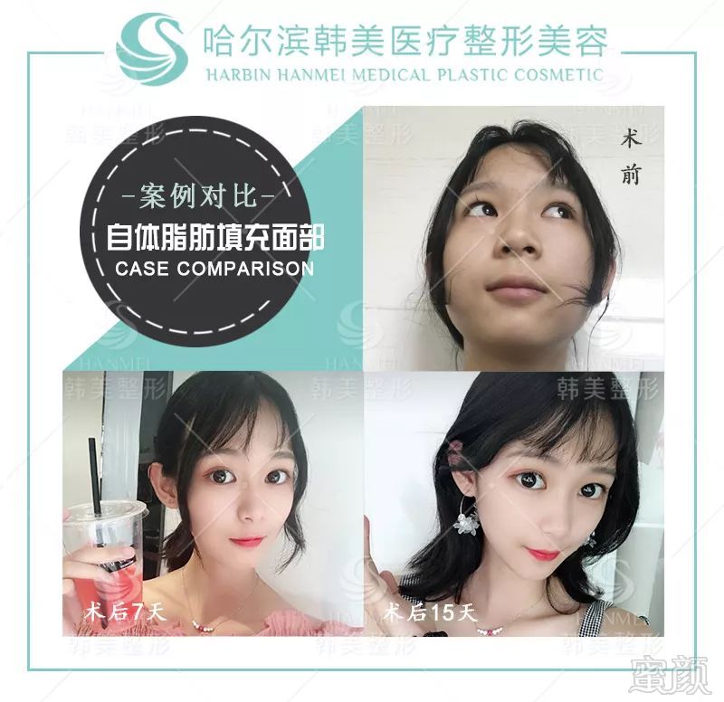 https://img.miyanlife.com/mnt/timg/190711/12204T025-10.jpg