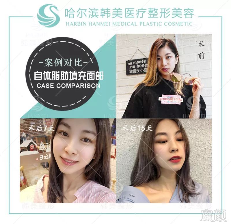 https://img.miyanlife.com/mnt/timg/190711/12204a129-11.jpg