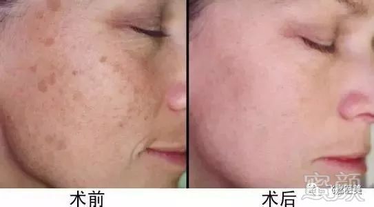 https://img.miyanlife.com/mnt/timg/190711/1224453443-10.jpg