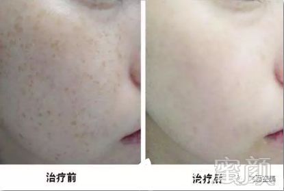 https://img.miyanlife.com/mnt/timg/190711/122445HM-11.jpg