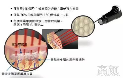 https://img.miyanlife.com/mnt/timg/190711/1225511051-1.jpg