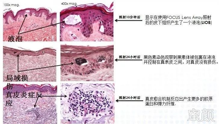 https://img.miyanlife.com/mnt/timg/190711/1225522411-3.jpg