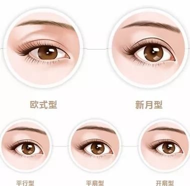 https://img.miyanlife.com/mnt/timg/190711/1245042F4-3.jpg