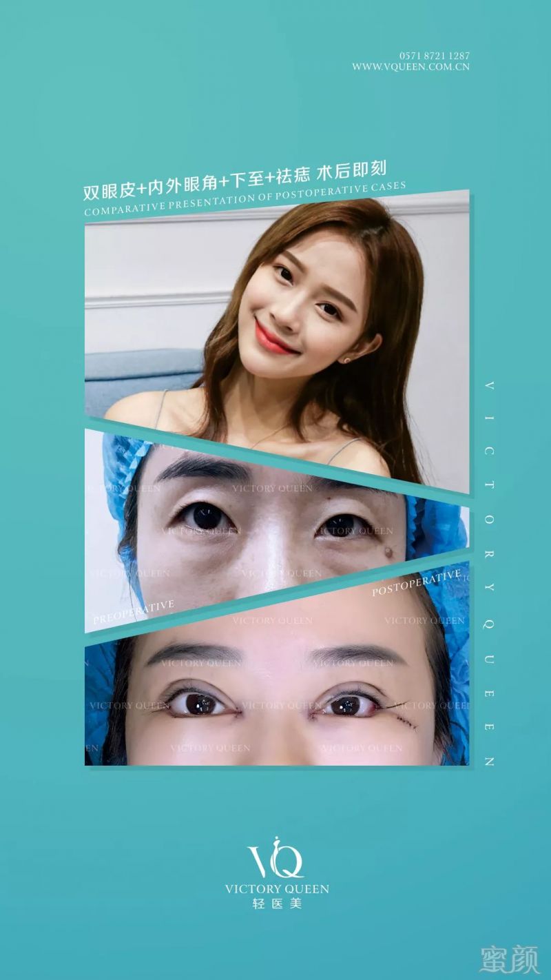 https://img.miyanlife.com/mnt/timg/190711/1245061202-8.jpg