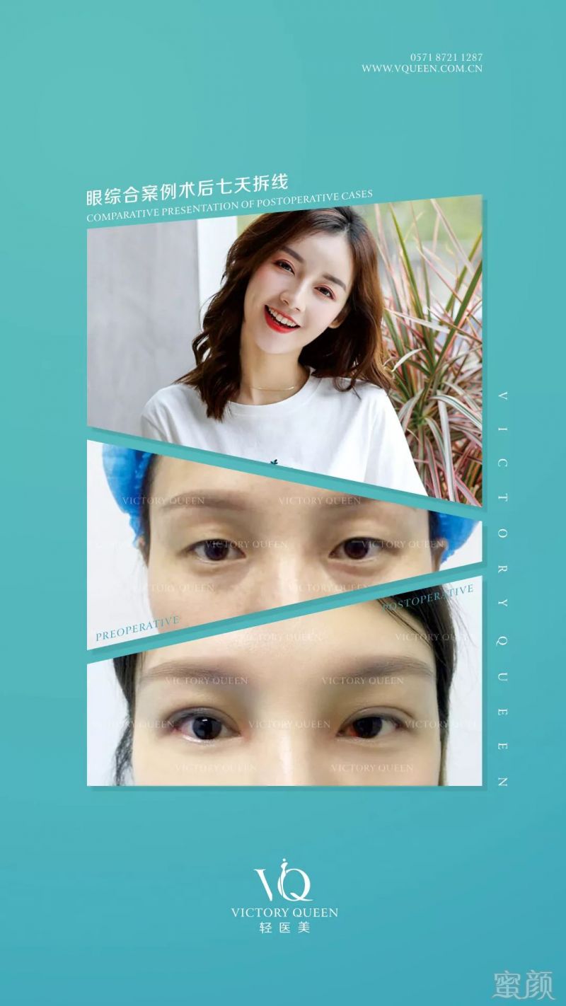 https://img.miyanlife.com/mnt/timg/190711/12450I458-9.jpg
