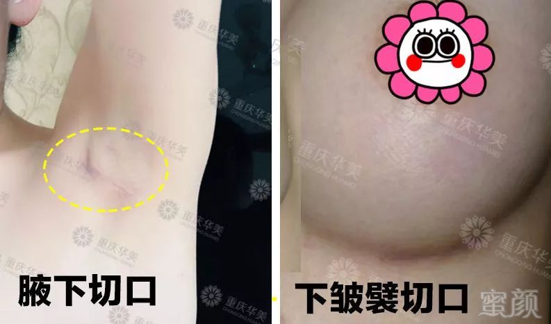https://img.miyanlife.com/mnt/timg/190711/12531GA7-18.jpg