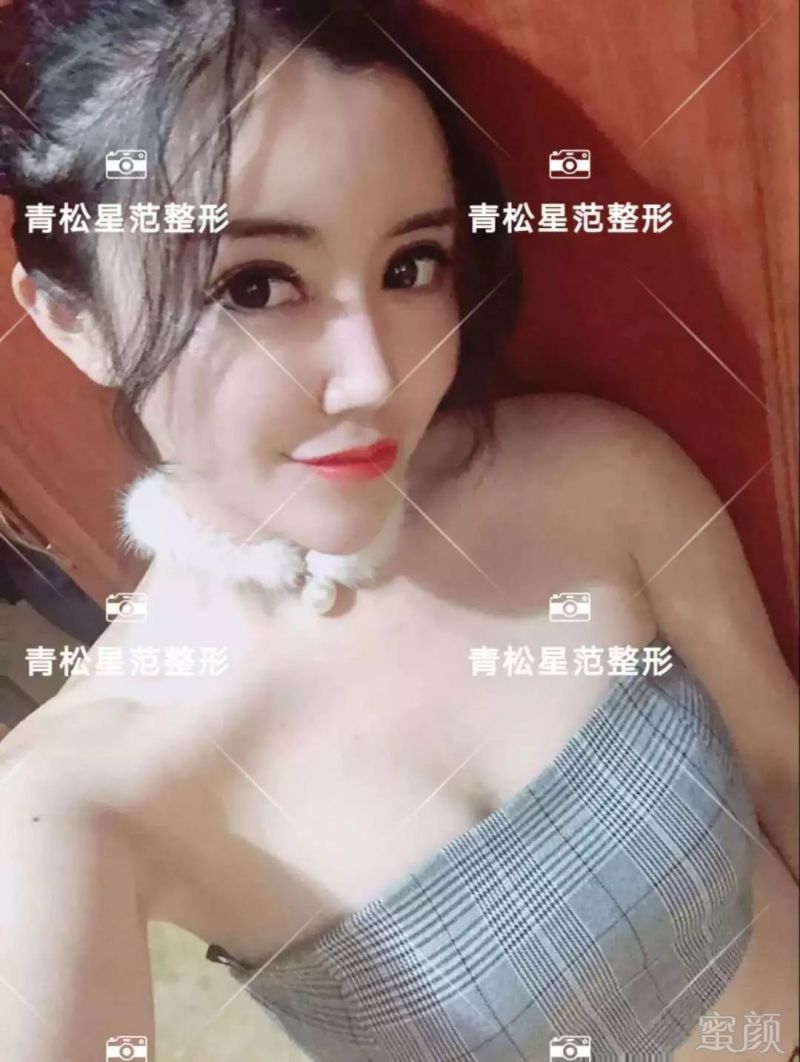 https://img.miyanlife.com/mnt/timg/190711/1254333035-16.jpg