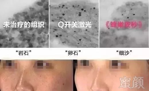https://img.miyanlife.com/mnt/timg/190712/1134244K1-3.jpg