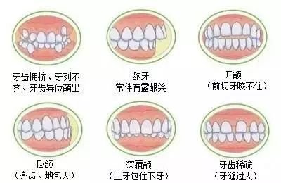 https://img.miyanlife.com/mnt/timg/190712/11463R0F-14.jpg
