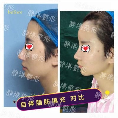 https://img.miyanlife.com/mnt/timg/190712/1146461207-0.jpg