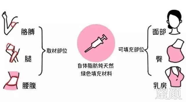 https://img.miyanlife.com/mnt/timg/190712/1146463419-2.jpg