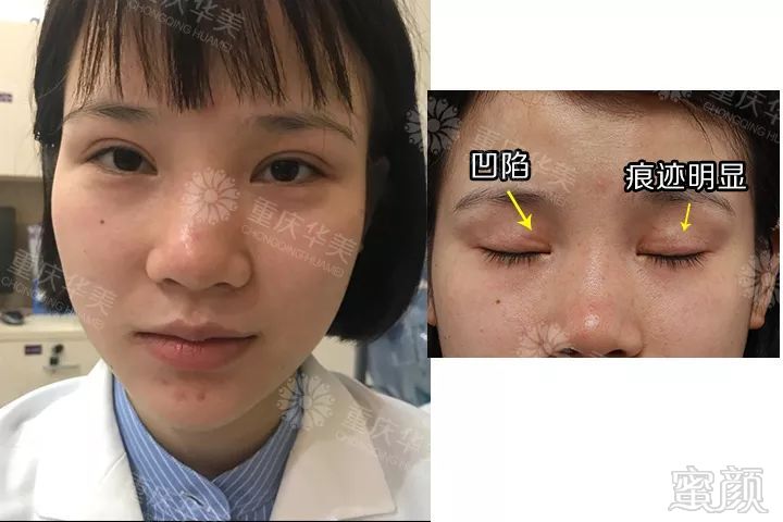 https://img.miyanlife.com/mnt/timg/190712/12153L304-16.jpg