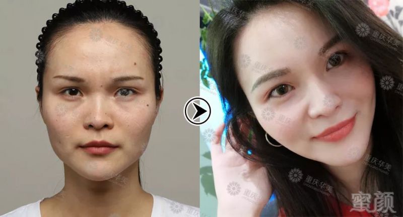 https://img.miyanlife.com/mnt/timg/190712/121954N40-19.jpg