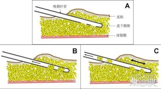 案例图片