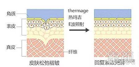 https://img.miyanlife.com/mnt/timg/190713/1225591253-5.jpg