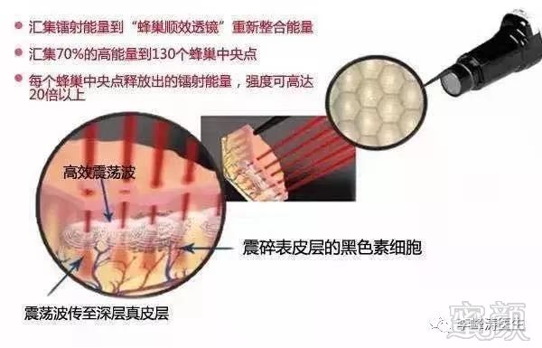 https://img.miyanlife.com/mnt/timg/190713/1306123S1-0.jpg