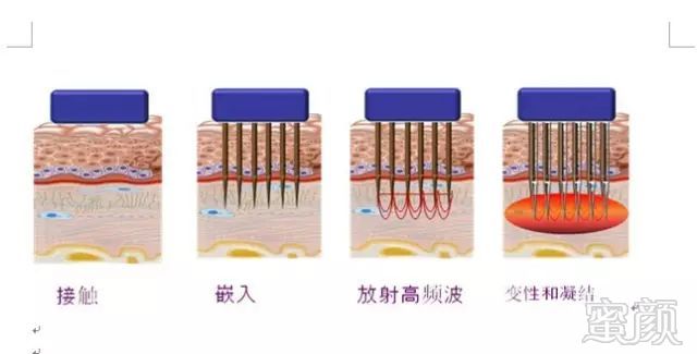 https://img.miyanlife.com/mnt/timg/190713/1323095427-3.jpg
