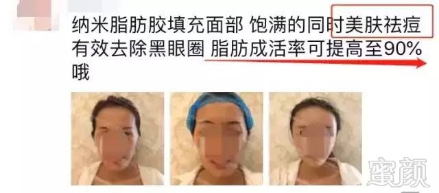 https://img.miyanlife.com/mnt/timg/190714/11524440O-5.jpg