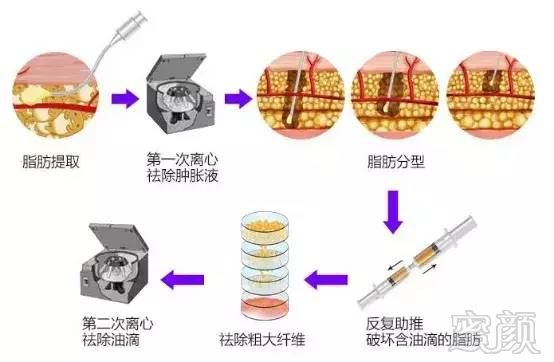 案例图片