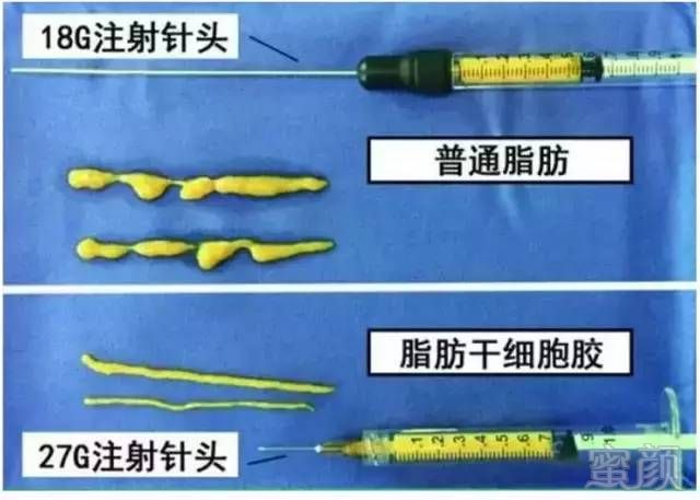 案例图片