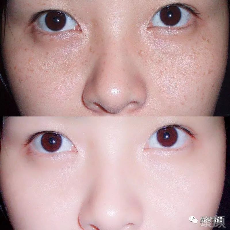 https://img.miyanlife.com/mnt/timg/190714/1201591V9-1.jpg