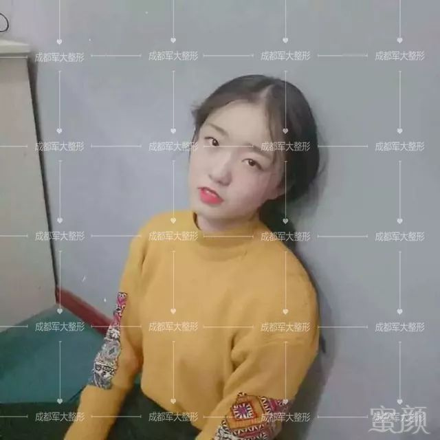 案例图片