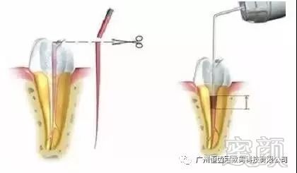 案例图片